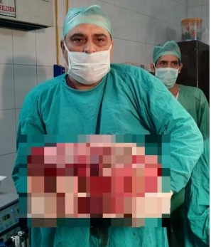 15キロの腫瘍